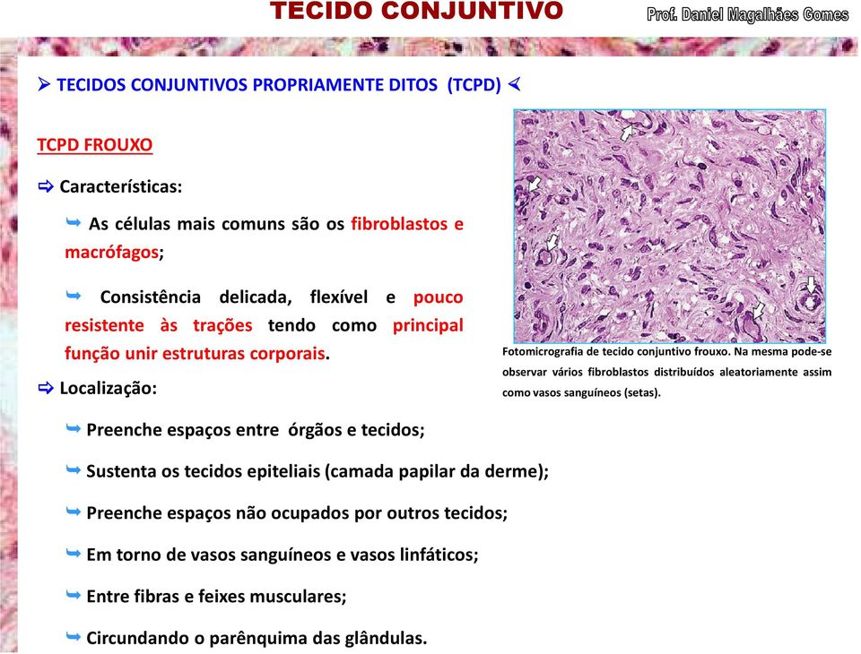 Na mesma pode-se observar vários fibroblastos distribuídos aleatoriamente assim como vasos sanguíneos (setas).