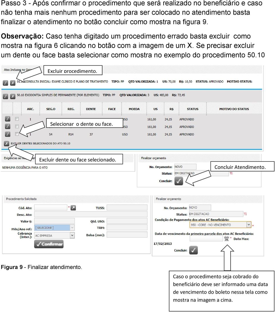 Se precisar excluir um dente ou face basta selecionar como mostra no exemplo do procedimento 50.10 Excluir procedimento. Selecionar o dente ou face. Excluir dente ou face selecionado.