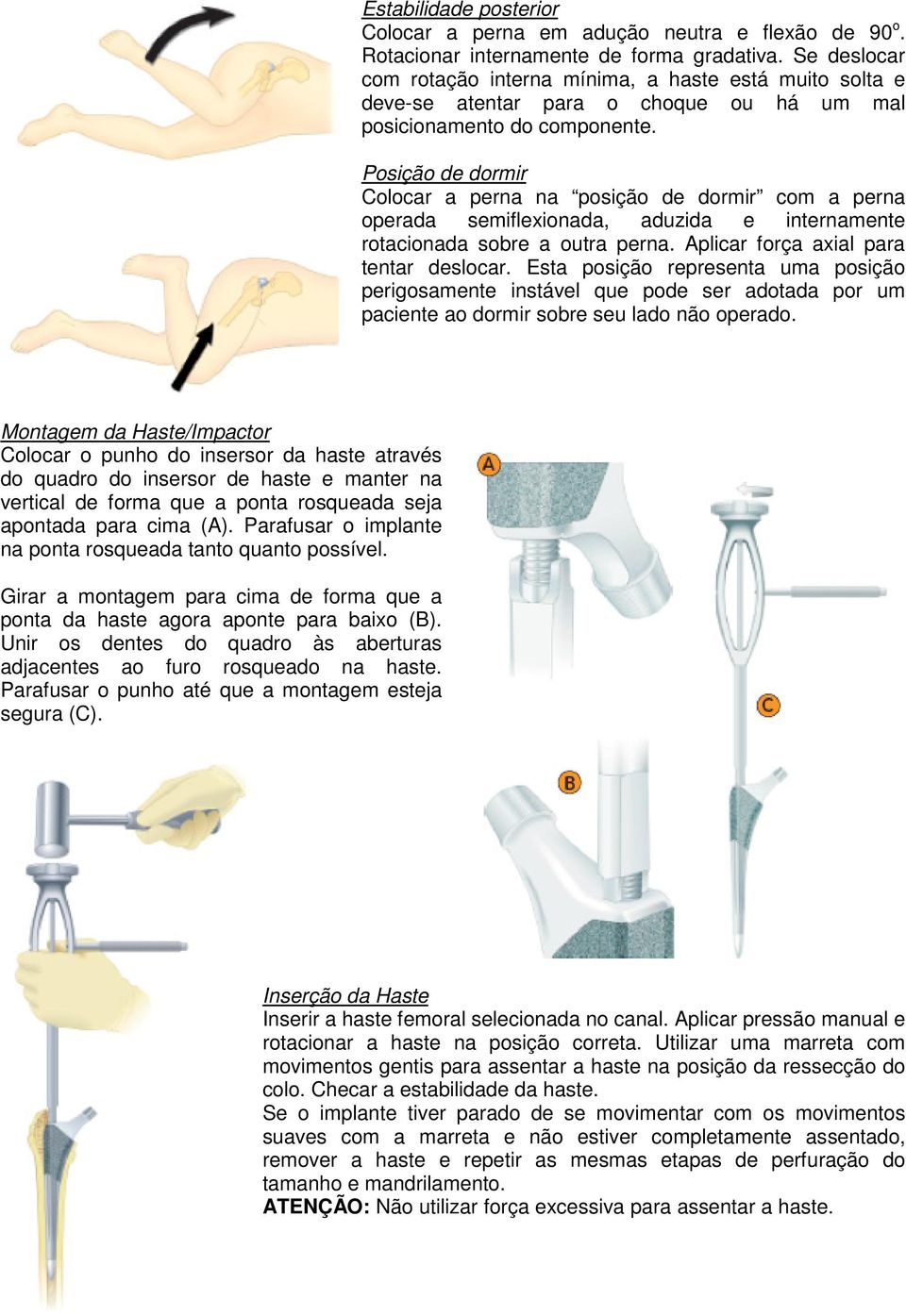 Posição de dormir Colocar a perna na posição de dormir com a perna operada semiflexionada, aduzida e internamente rotacionada sobre a outra perna. Aplicar força axial para tentar deslocar.