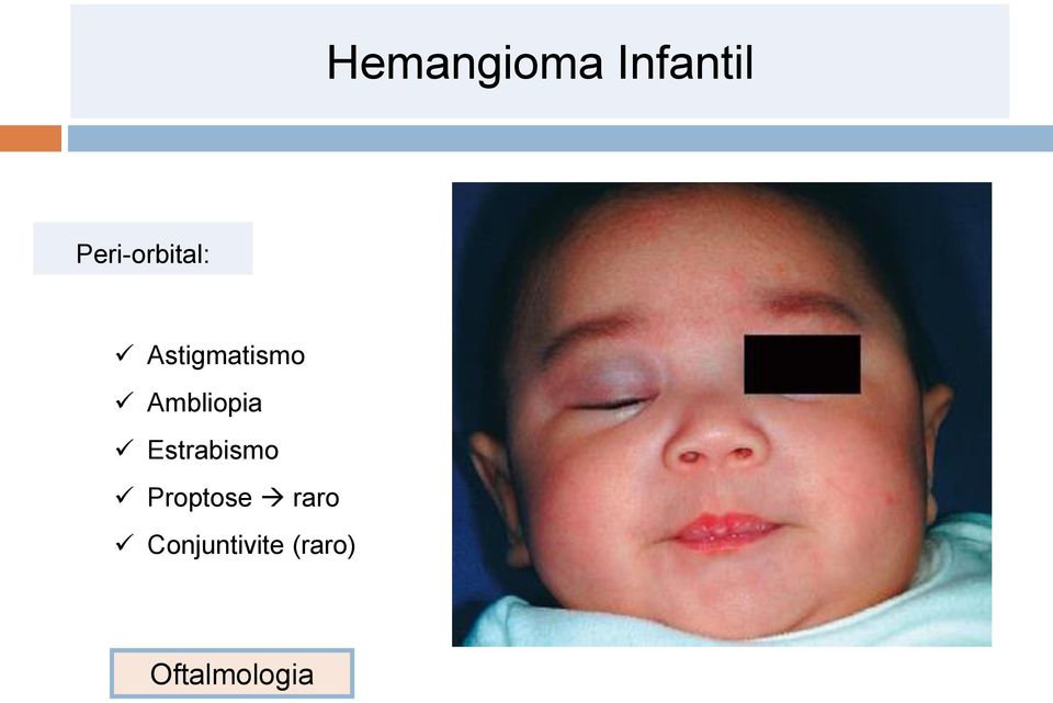 Estrabismo Proptose