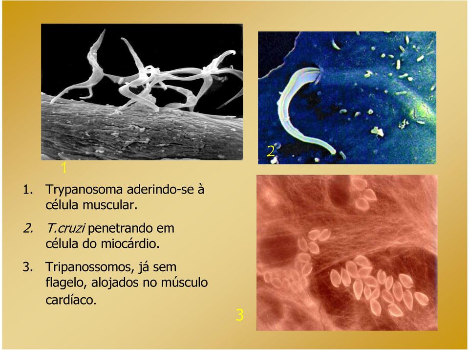 cruzi penetrando em célula do miocárdio.