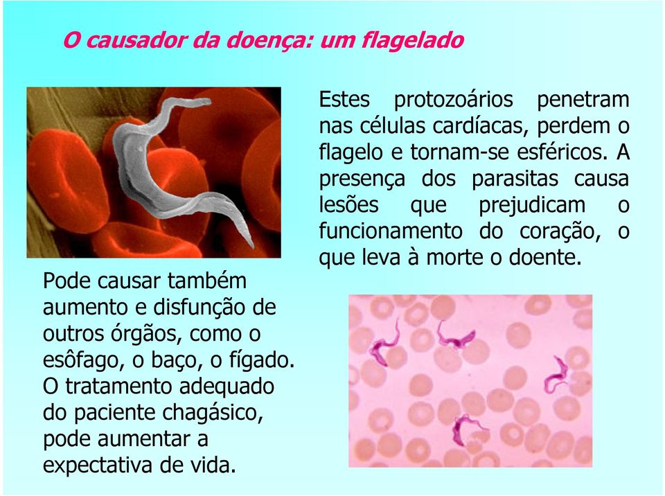 O tratamento adequado do paciente chagásico, pode aumentar a expectativa de vida.