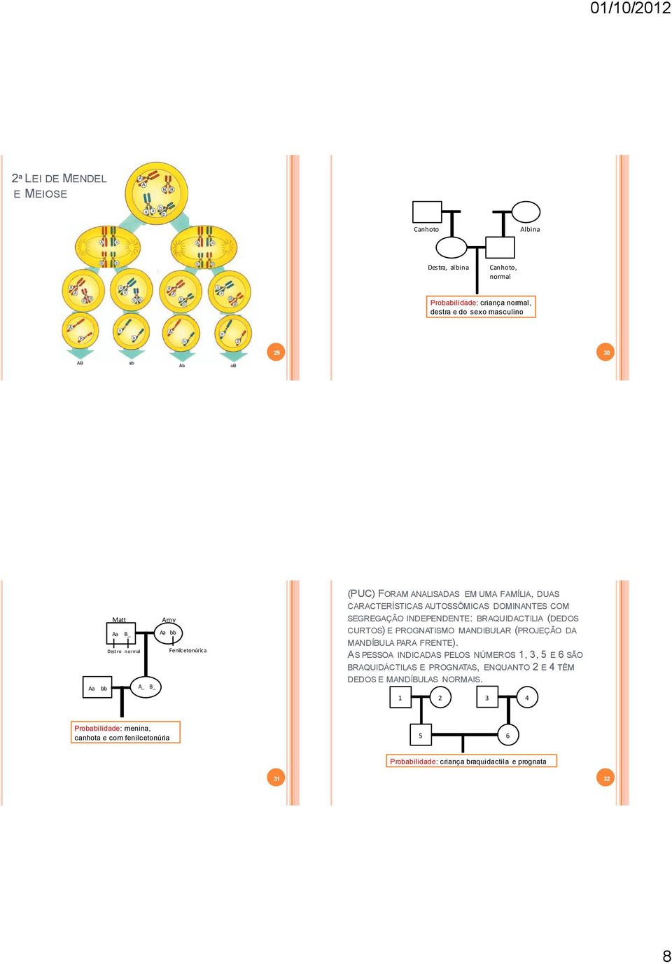 BRAQUIDACTILIA (DEDOS CURTOS) E PROGNATISMO MANDIBULAR (PROJEÇÃO DA MANDÍBULA PARA FRENTE).