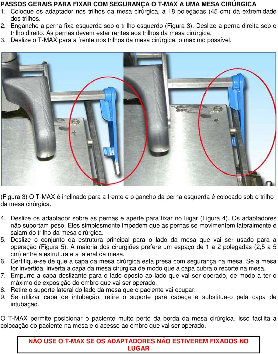 (Figura 3) O T-MAX é inclinado para a frente e o gancho da perna esquerda é colocado sob o trilho da mesa cirúrgica. 4. Deslize os adaptador sobre as pernas e aperte para fixar no lugar (Figura 4).