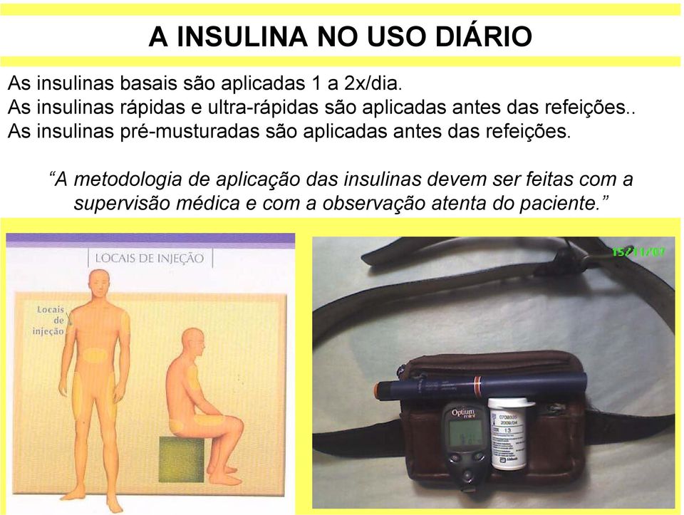 . As insulinas pré-musturadas são aplicadas antes das refeições.