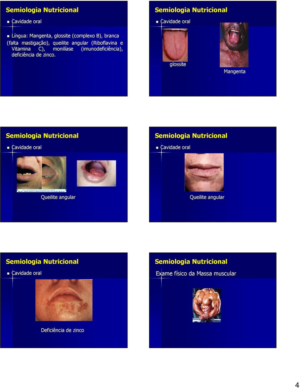 (imunodeficiência), deficiência de zinco.