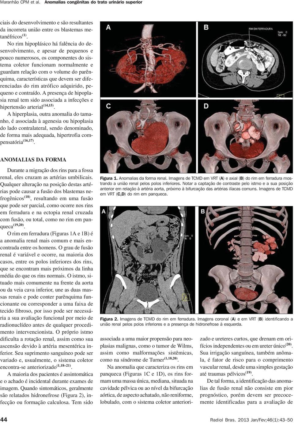 características que devem ser diferenciadas do rim atrófico adquirido, pequeno e contraído. A presença de hipoplasia renal tem sido associada a infecções e hipertensão arterial (14,15).