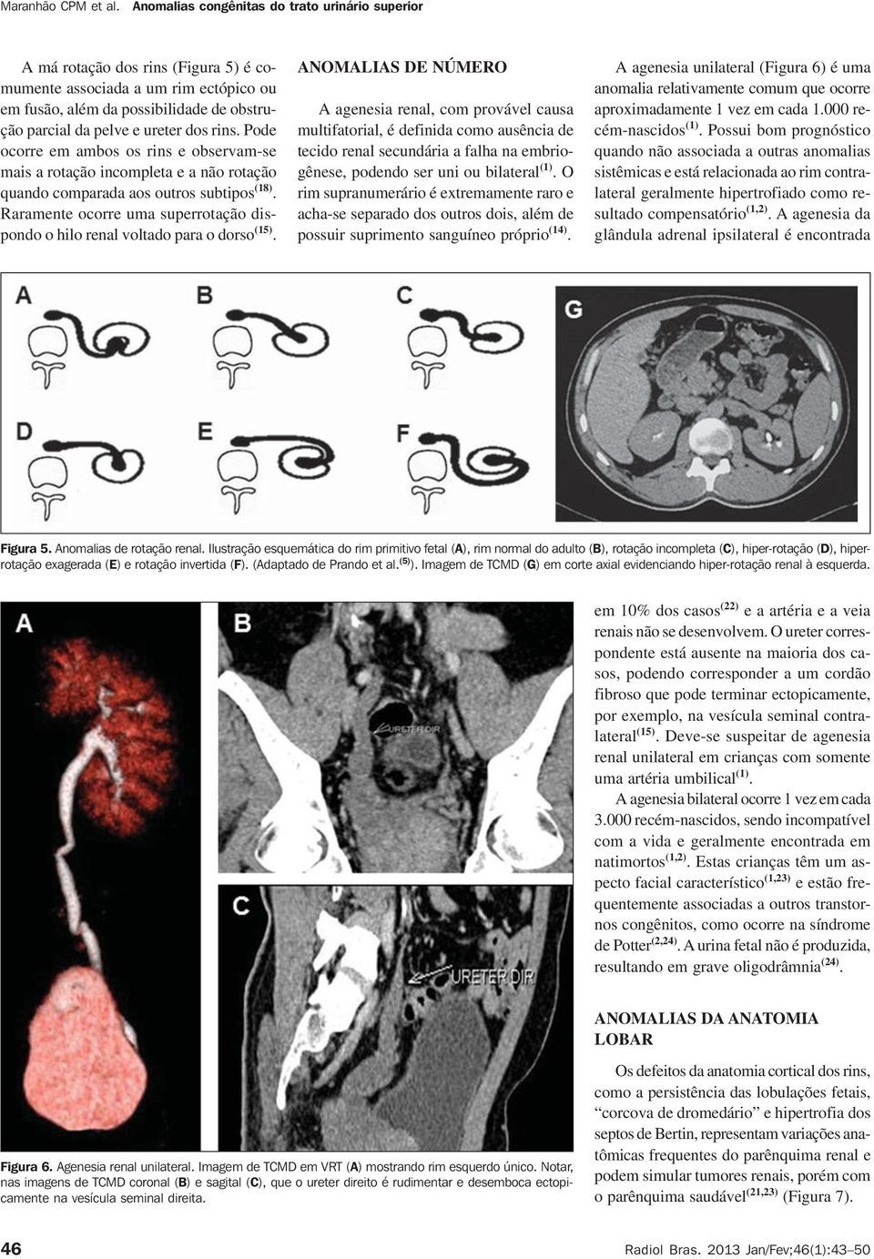 Raramente ocorre uma superrotação dispondo o hilo renal voltado para o dorso (15).