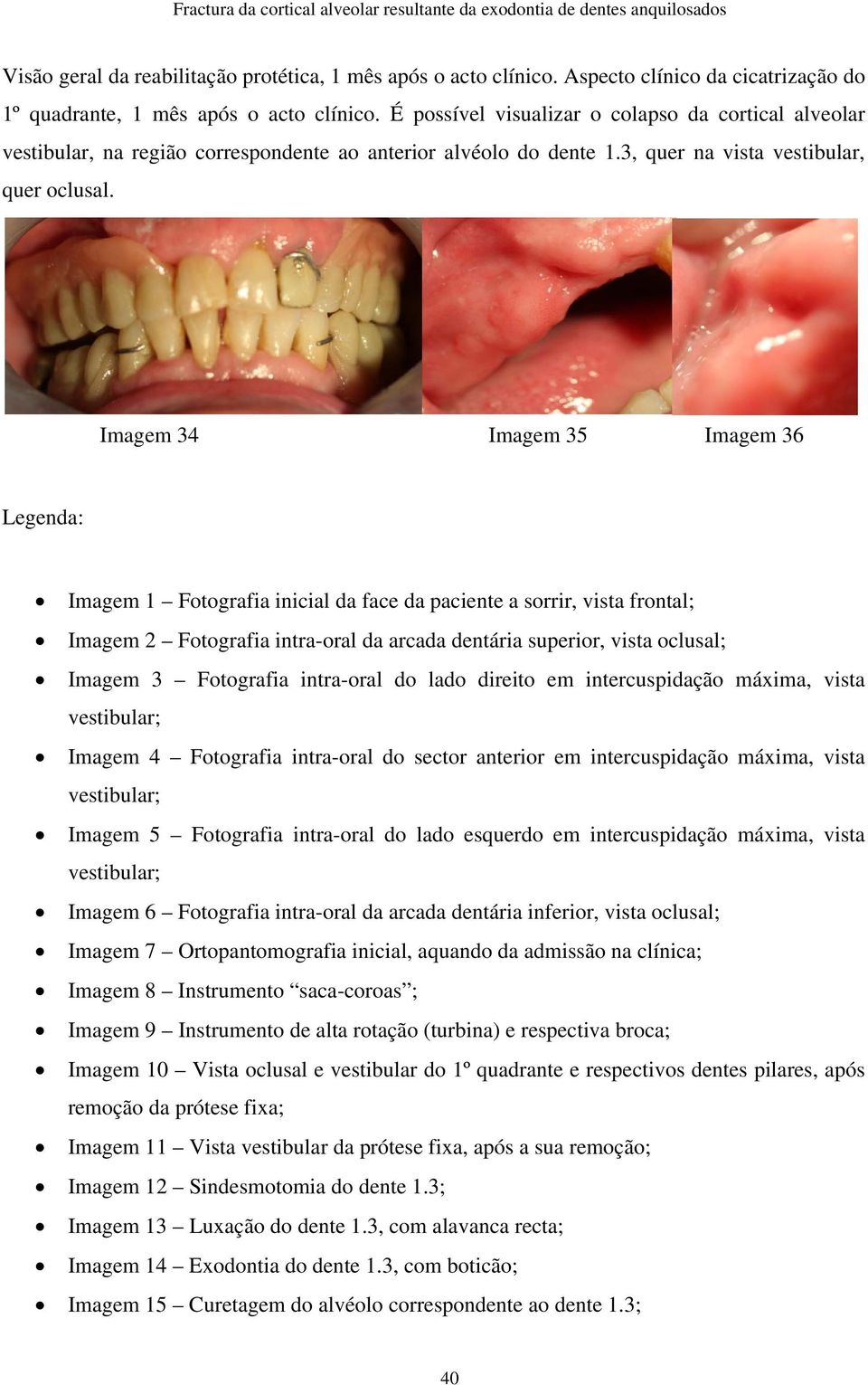 Imagem 34 Imagem 35 Imagem 36 Legenda: Imagem 1 Fotografia inicial da face da paciente a sorrir, vista frontal; Imagem 2 Fotografia intra-oral da arcada dentária superior, vista oclusal; Imagem 3