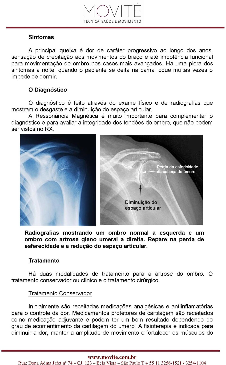 O Diagnóstico O diagnóstico é feito através do exame físico e de radiografias que mostram o desgaste e a diminuição do espaço articular.