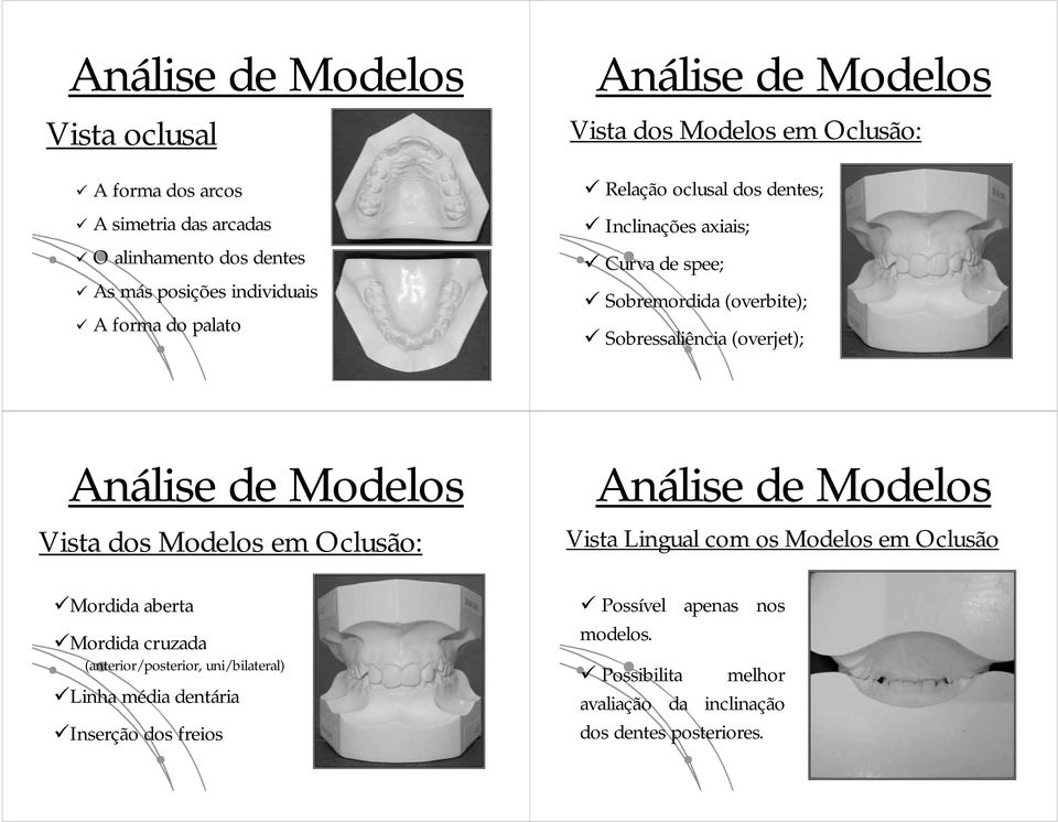Vista dos Modelos em Oclusão: Mordida aberta Mordida cruzada (anterior/posterior, uni/bilateral) Linha h média dentária Inserção ç dos