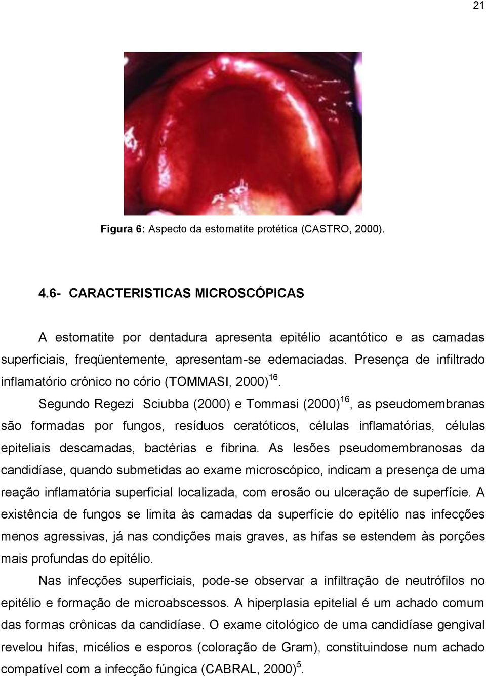 Presença de infiltrado inflamatório crônico no cório (TOMMASI, 2000) 16.