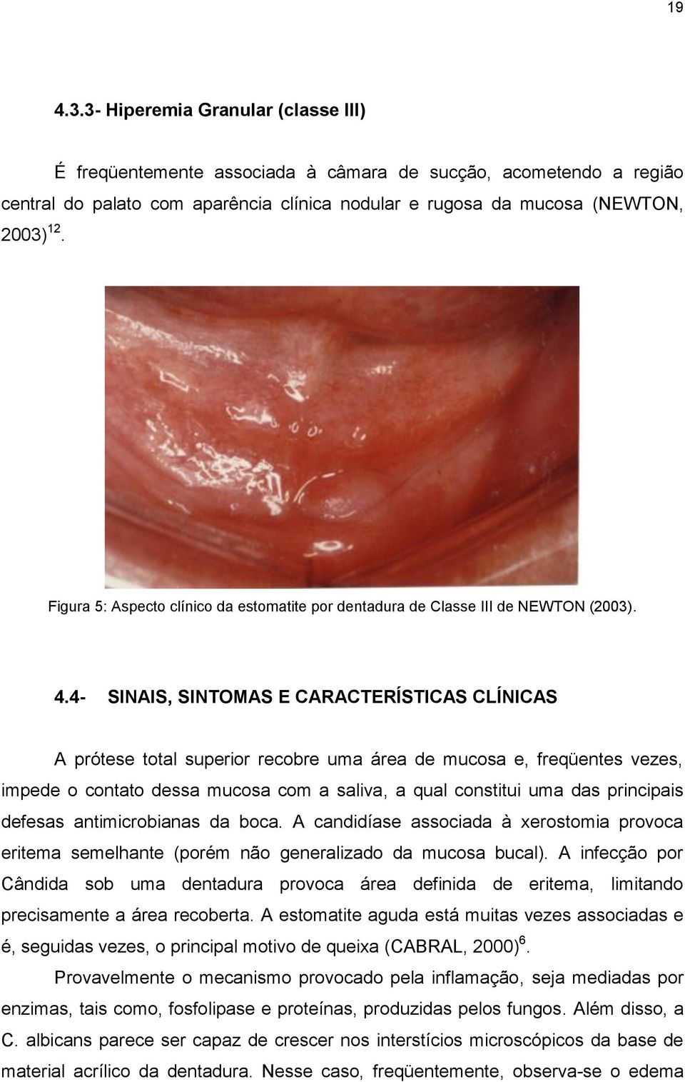 4- SINAIS, SINTOMAS E CARACTERÍSTICAS CLÍNICAS A prótese total superior recobre uma área de mucosa e, freqüentes vezes, impede o contato dessa mucosa com a saliva, a qual constitui uma das principais