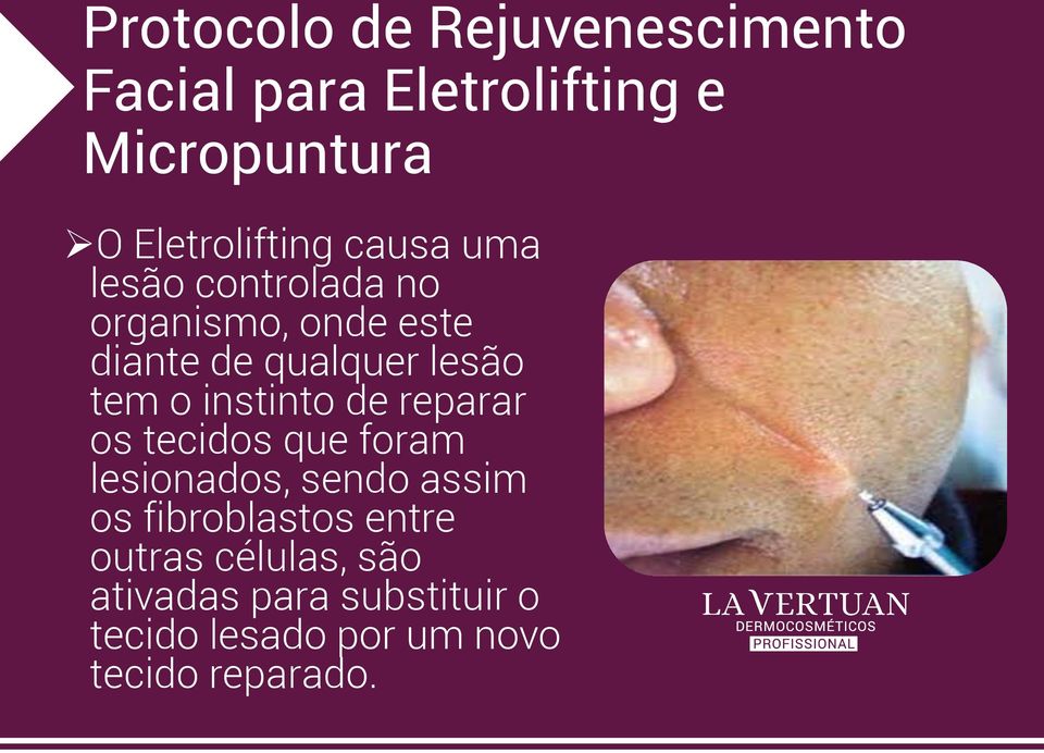 instinto de reparar os tecidos que foram lesionados, sendo assim os fibroblastos entre