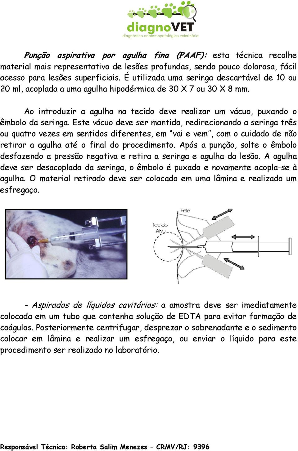 Este vácuo deve ser mantido, redirecionando a seringa três ou quatro vezes em sentidos diferentes, em vai e vem, com o cuidado de não retirar a agulha até o final do procedimento.