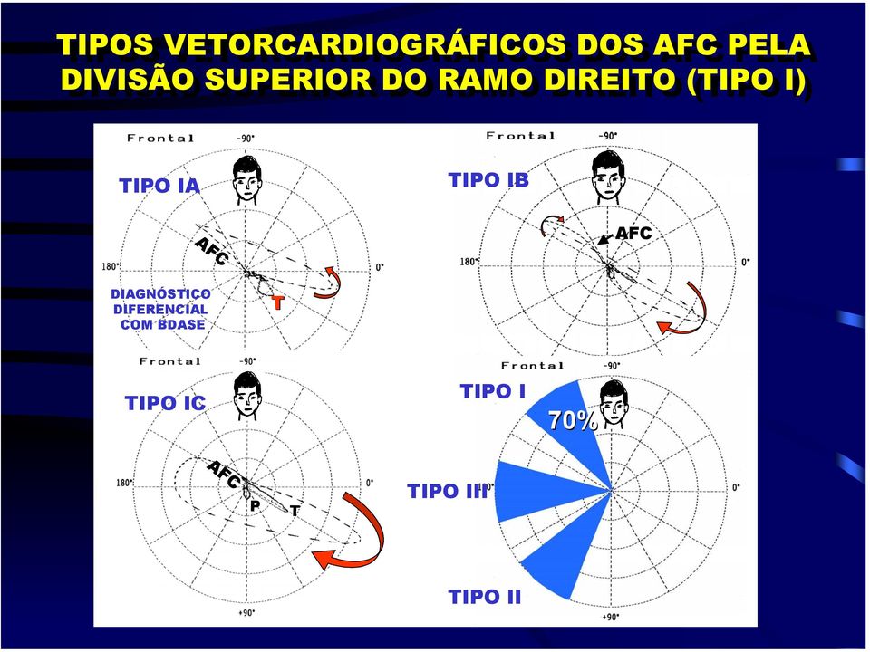 TIPO IA TIPO IB ECD AFC DIAGNÓSTICO DIFERENCIAL