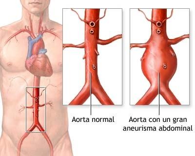 Anomalias de fluxo O que ocorre com a pressão quando há