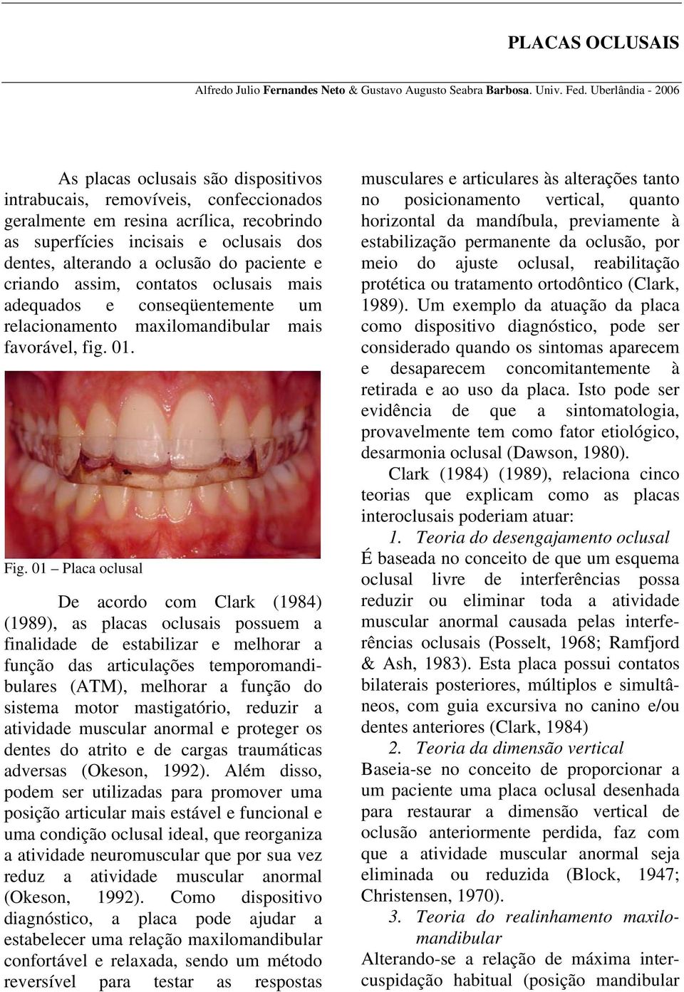 oclusão do paciente e criando assim, contatos oclusais mais adequados e conseqüentemente um relacionamento maxilomandibular mais favorável, fig. 01. Fig.