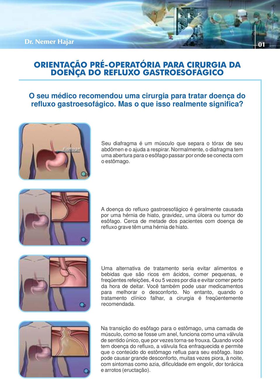 A doença do refluxo gastroesofágico é geralmente causada por uma hérnia de hiato, gravidez, uma úlcera ou tumor do esôfago.