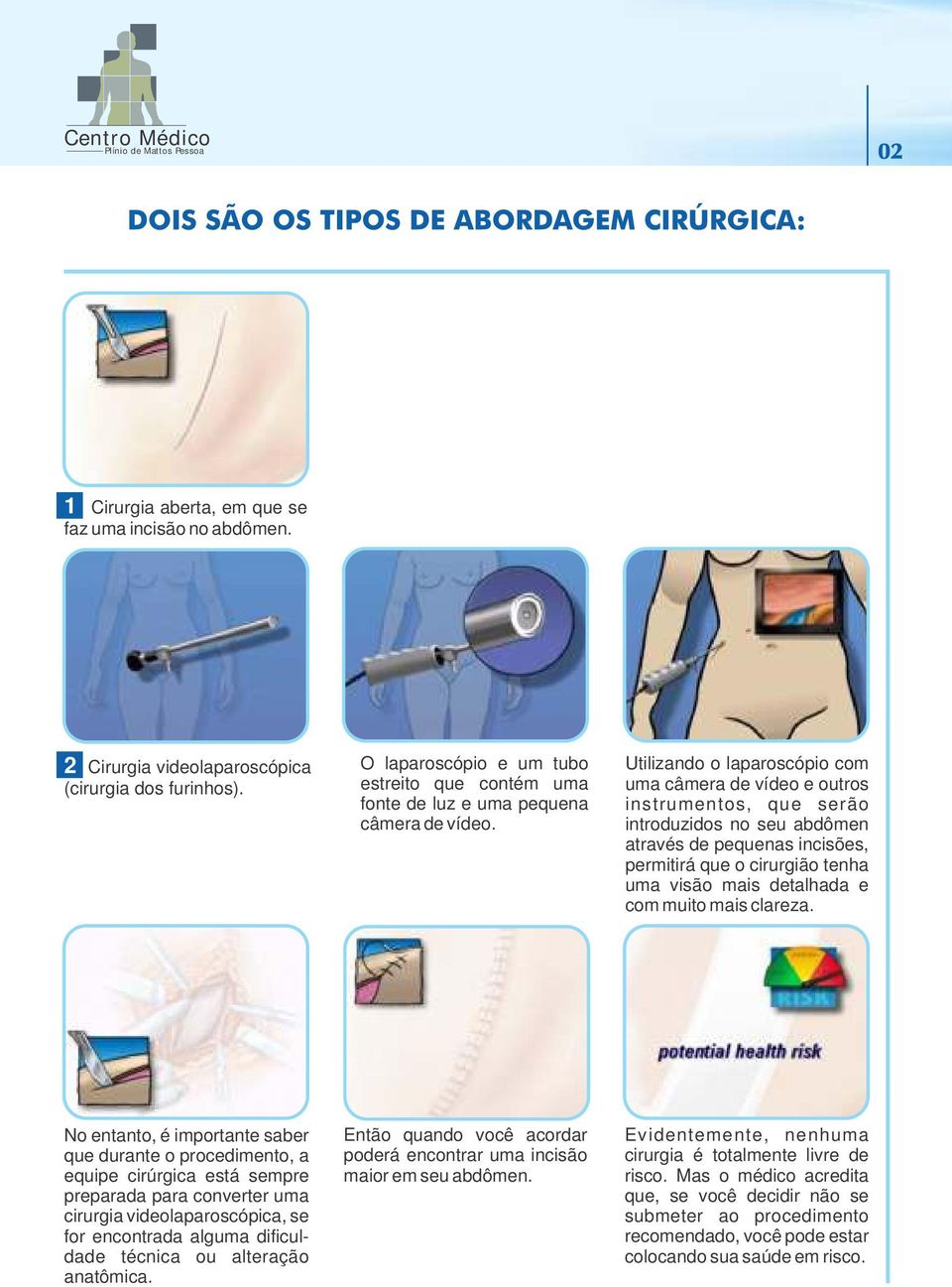 Utilizando o laparoscópio com uma câmera de vídeo e outros instrumentos, que serão introduzidos no seu abdômen através de pequenas incisões, permitirá que o cirurgião tenha uma visão mais detalhada e