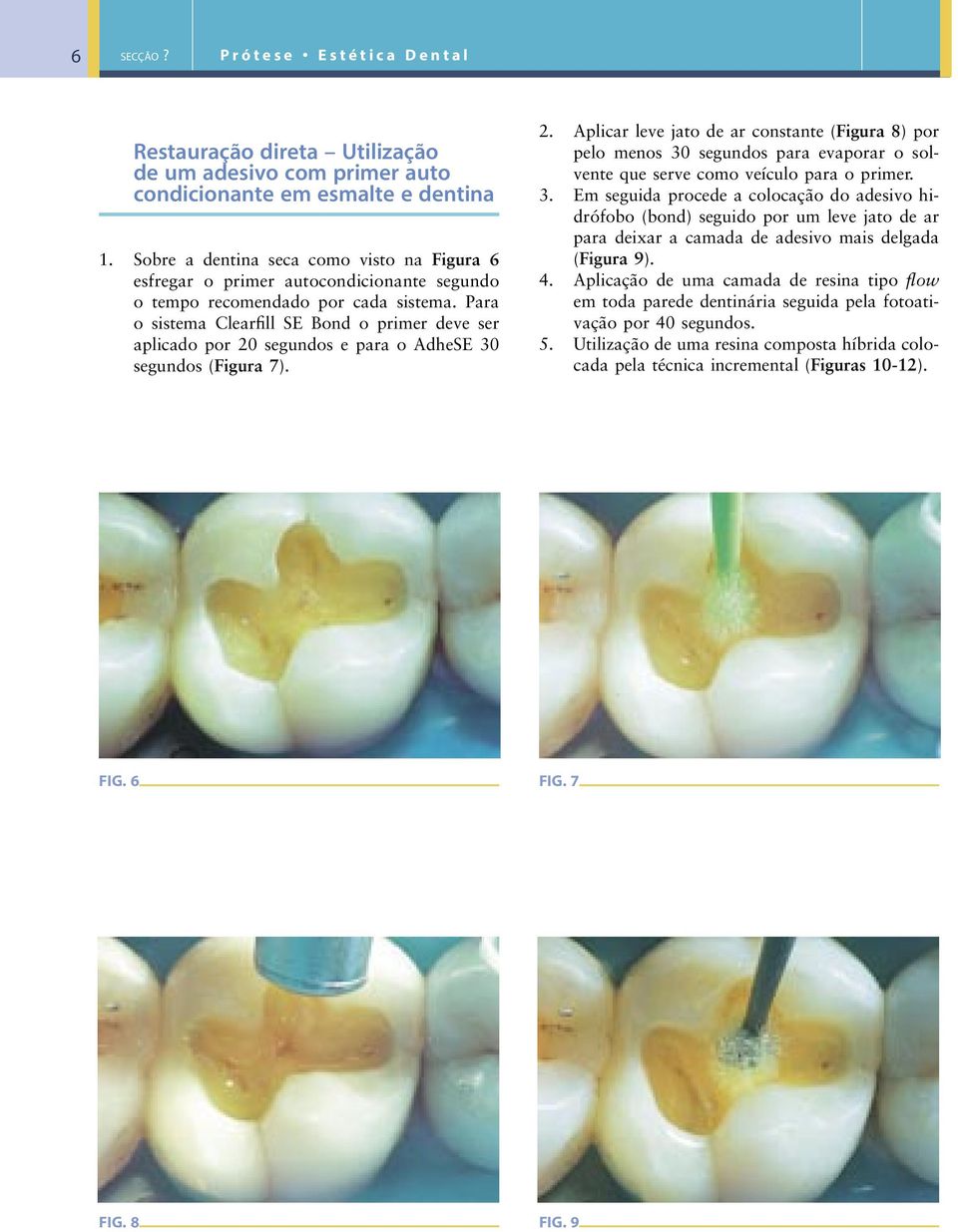 Para o sistema Clearfill SE Bond o primer deve ser aplicado por 20