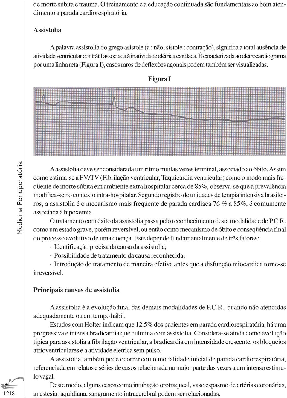 É caracterizada ao eletrocardiograma por uma linha reta (Figura I), casos raros de deflexões agonais podem também ser visualizadas.
