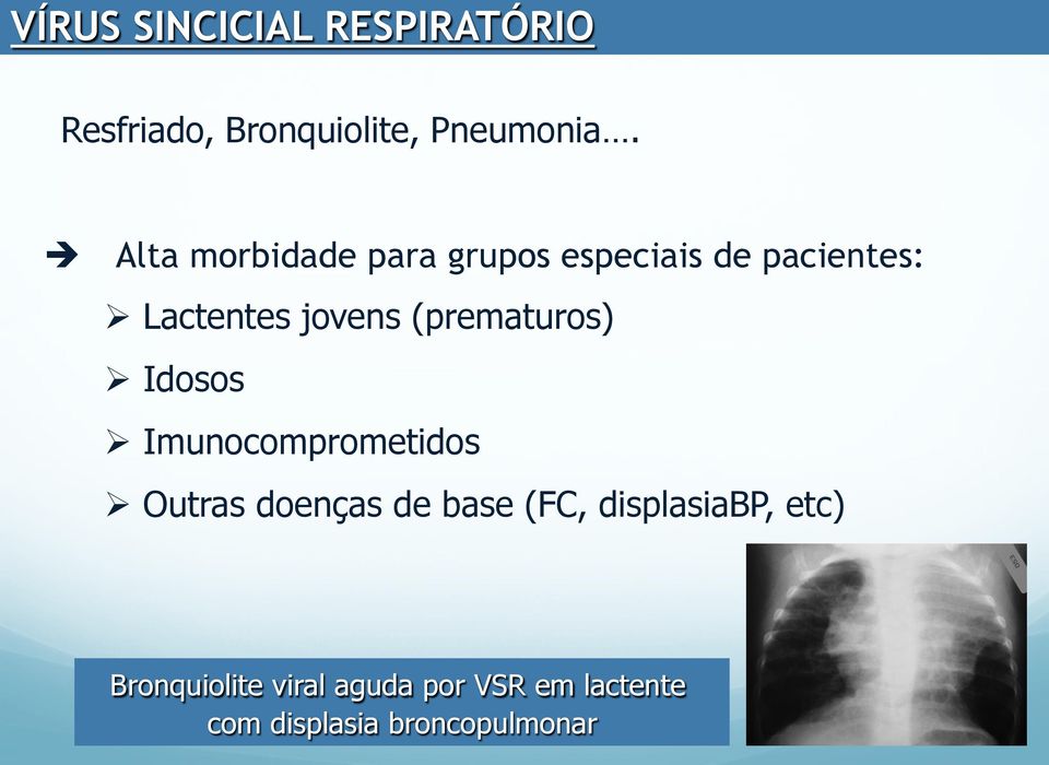 (prematuros) Ø Idosos Ø Imunocomprometidos Ø Outras doenças de base (FC,