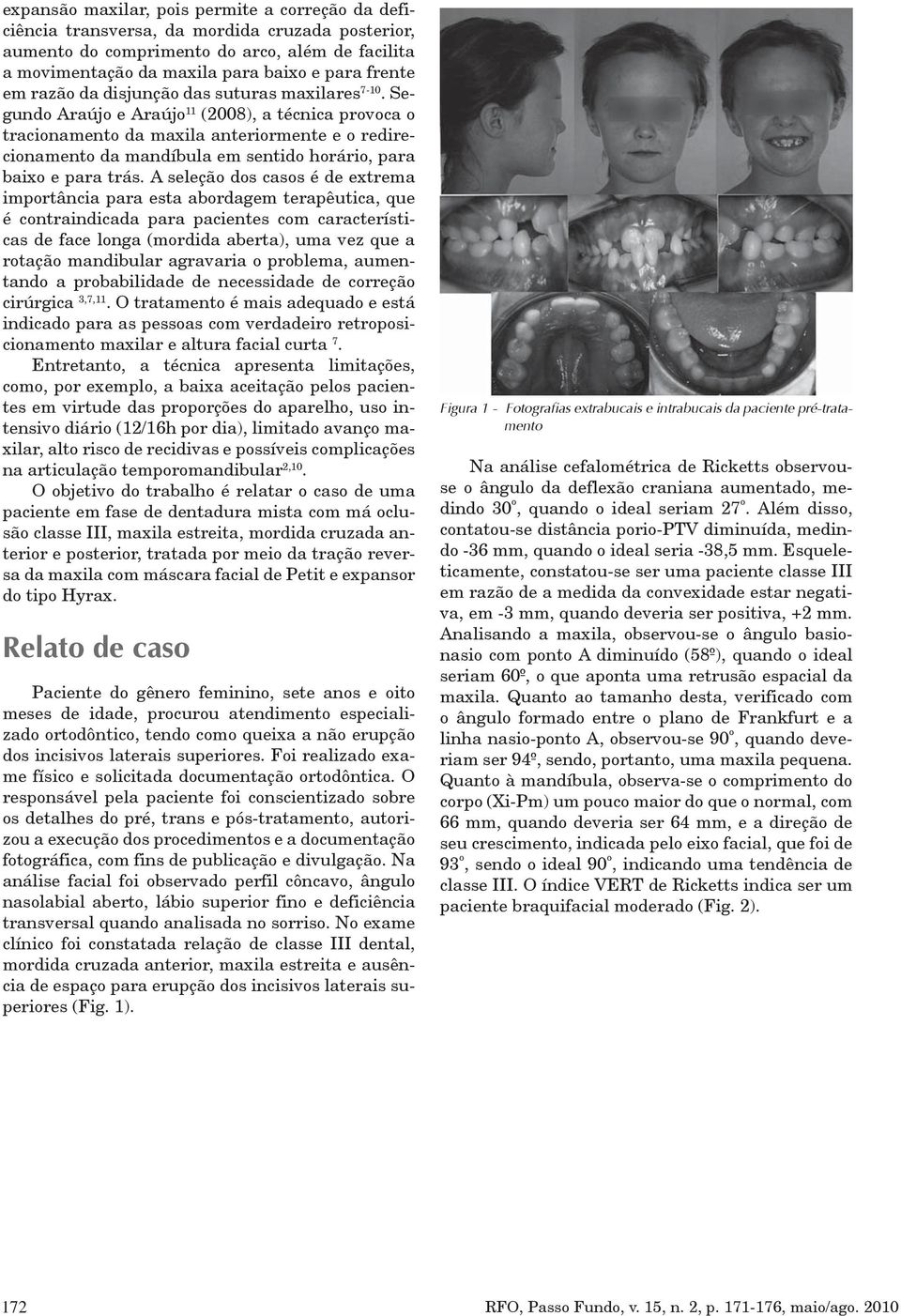 Segundo Araújo e Araújo 11 (2008), a técnica provoca o tracionamento da maxila anteriormente e o redirecionamento da mandíbula em sentido horário, para baixo e para trás.