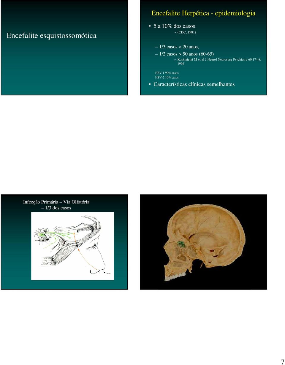 et al J Neurol Neurosurg Psychiatry 60:174-8, 1996 HSV-1 90% casos HSV-2 10%