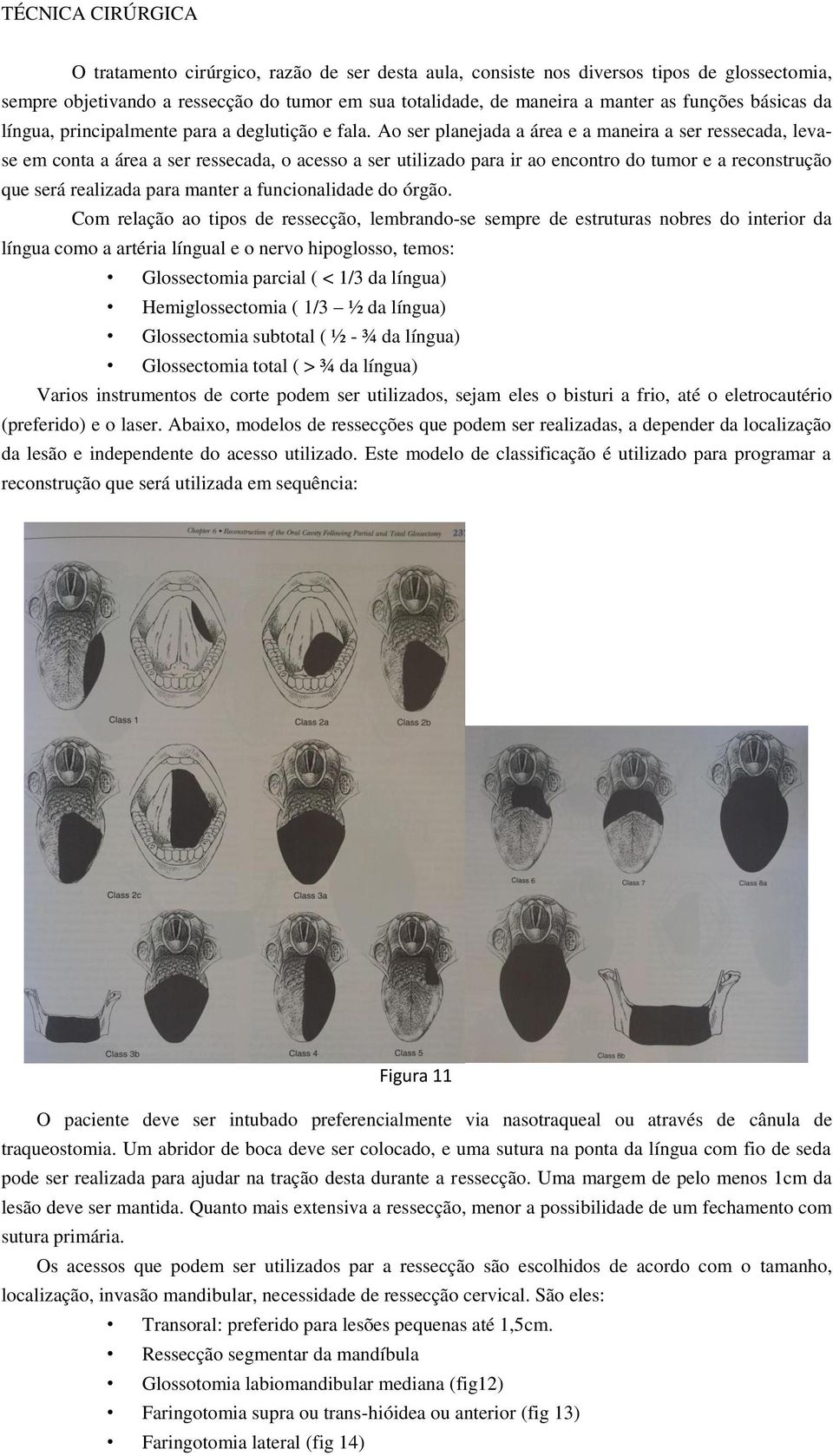 Ao ser planejada a área e a maneira a ser ressecada, levase em conta a área a ser ressecada, o acesso a ser utilizado para ir ao encontro do tumor e a reconstrução que será realizada para manter a