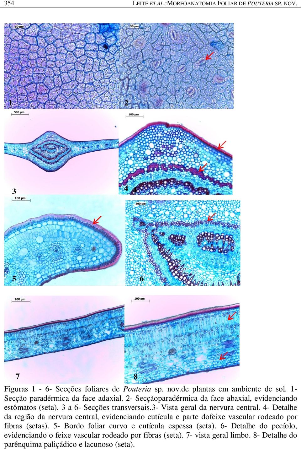 3- Vista geral da nervura central. 4- Detalhe da região da nervura central, evidenciando cutícula e parte dofeixe vascular rodeado por fibras (setas).