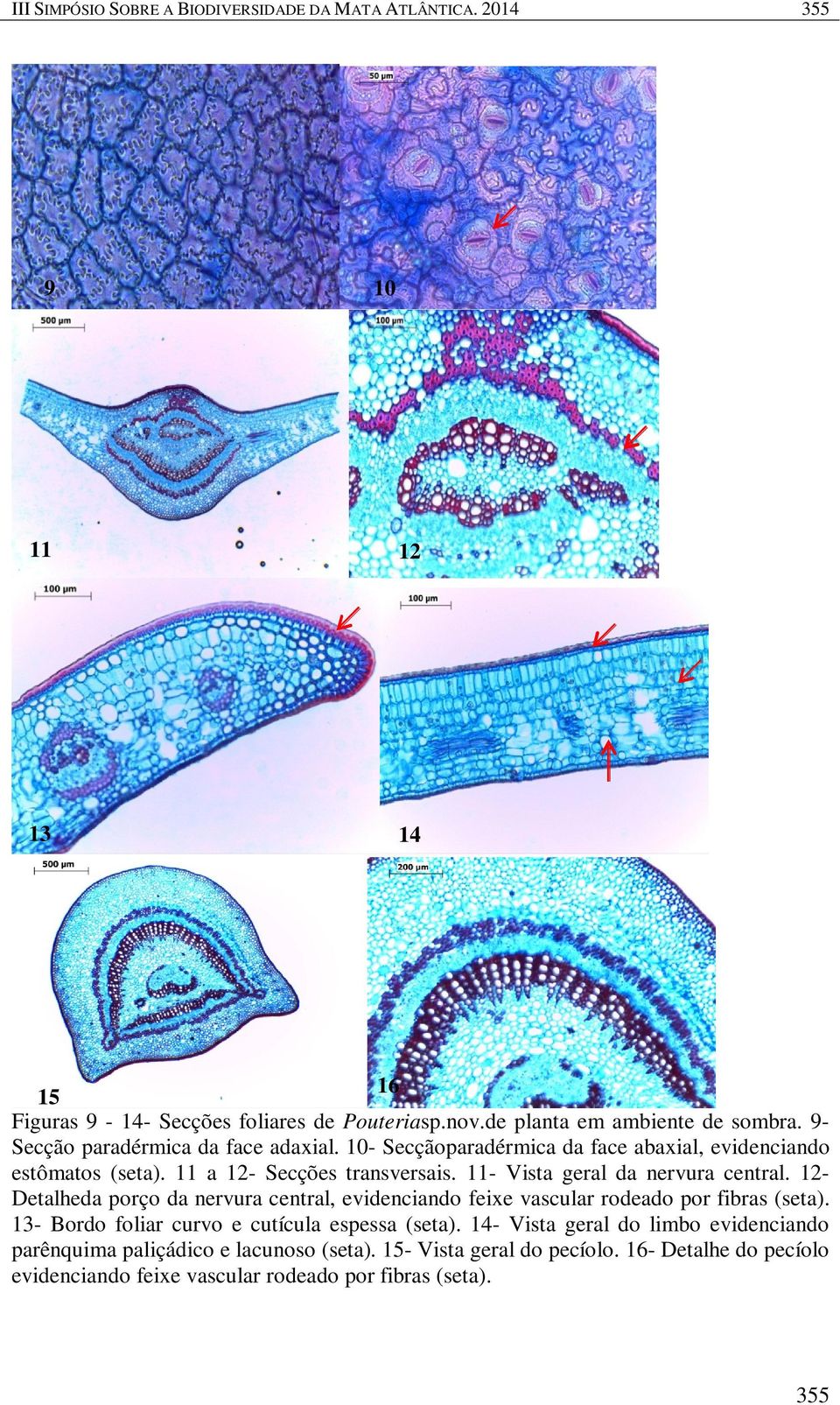 11- Vista geral da nervura central. 12Detalheda porço da nervura central, evidenciando feixe vascular rodeado por fibras (seta).