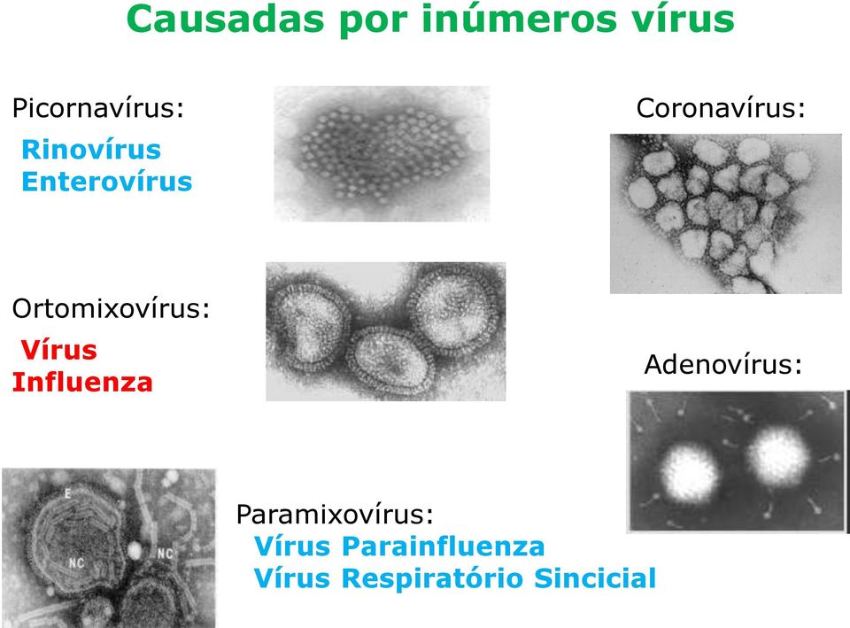 Ortomixovírus: Vírus Influenza Adenovírus: