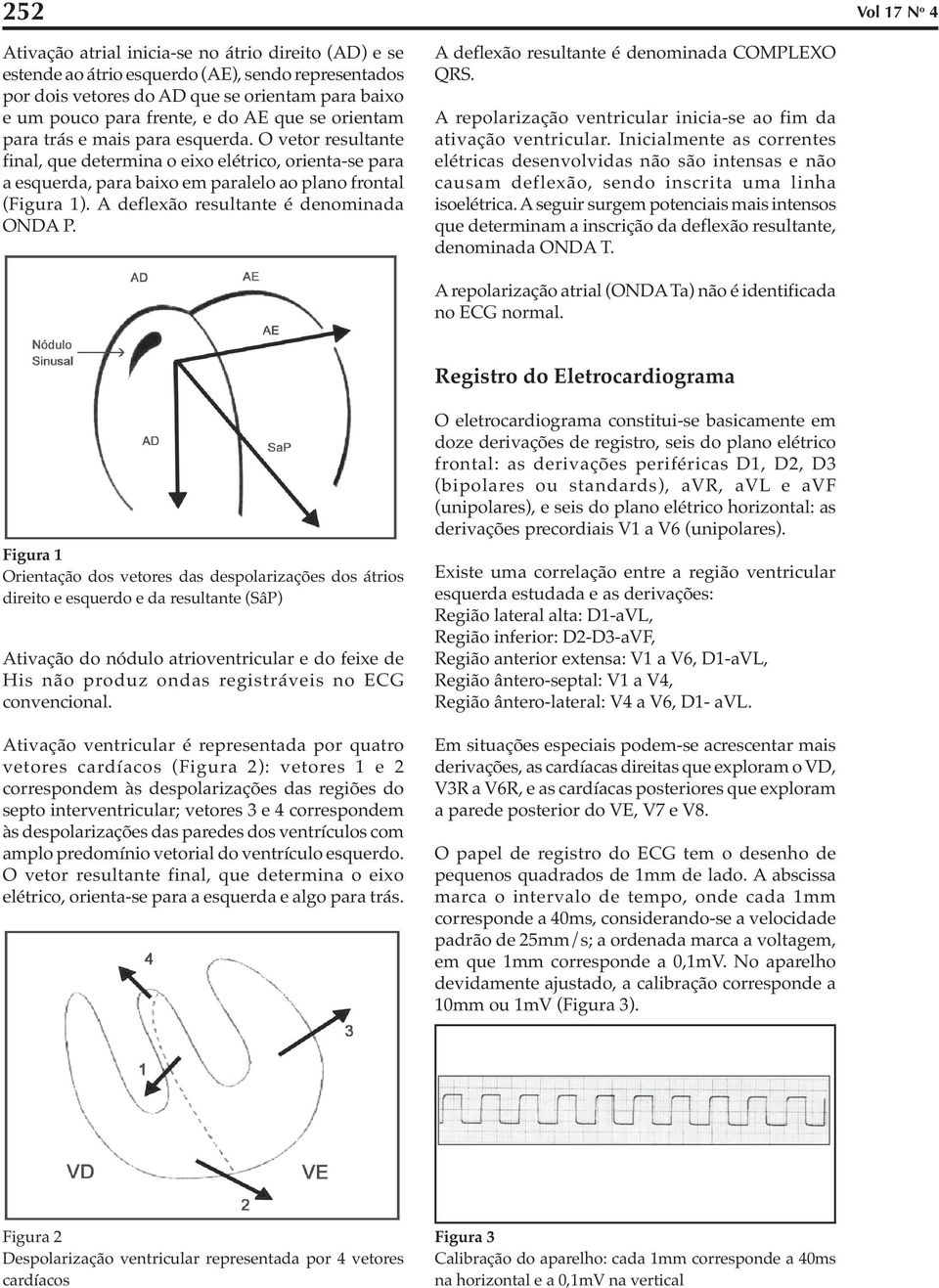 A deflexão resultante é denominada ONDA P. A deflexão resultante é denominada COMPLEXO QRS. A repolarização ventricular inicia-se ao fim da ativação ventricular.