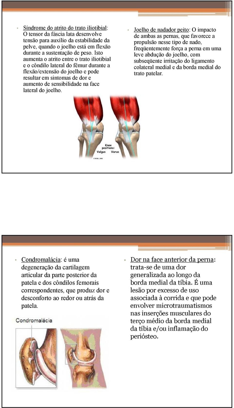 Joelho de nadador peito: O impacto de ambas as pernas, que favorece a propulsão nesse tipo de nado, freqüentemente força a perna em uma leve abdução do joelho, com subseqüente irritação do ligamento