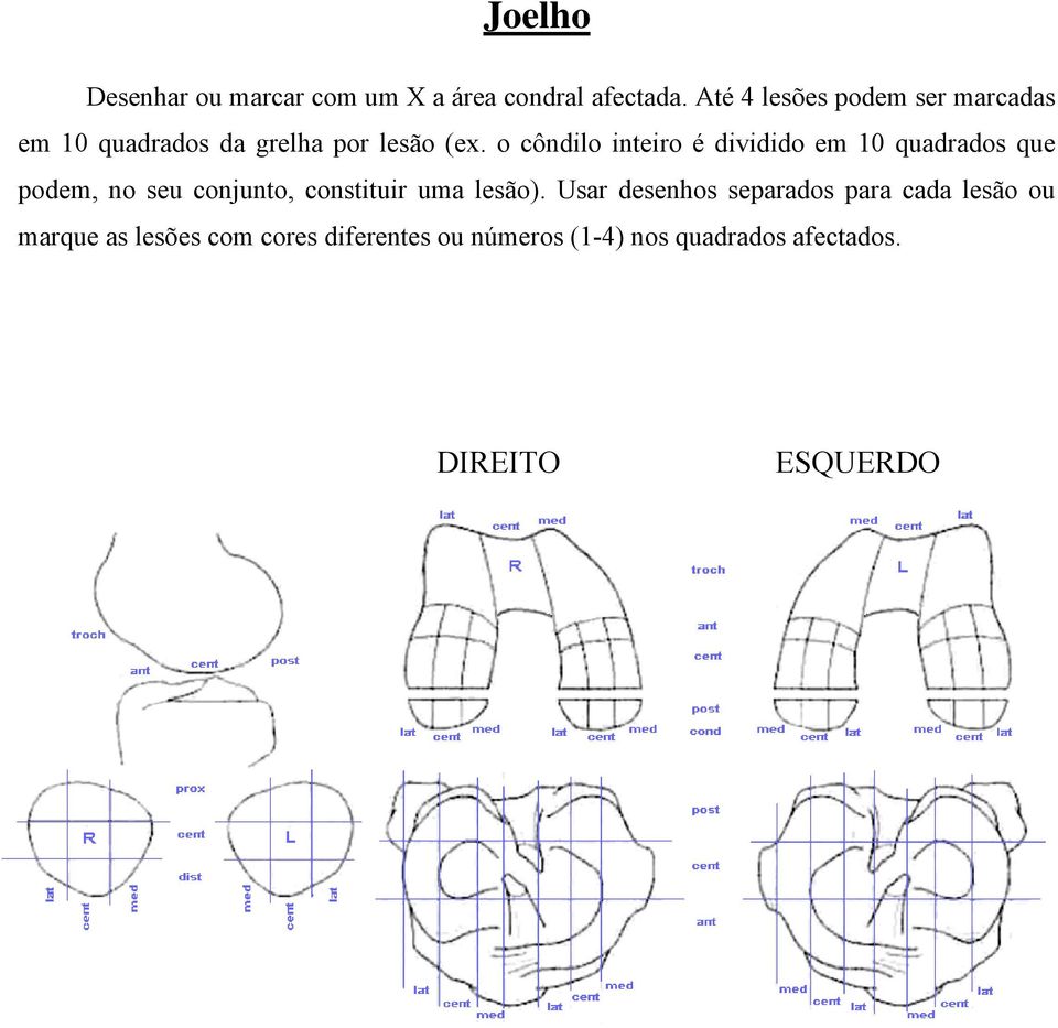 o côndilo inteiro é dividido em 10 quadrados que podem, no seu conjunto, constituir uma