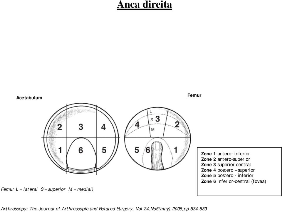 superior Zone 5 postero - inferior Zone 6 inferior-central (fovea) Arthroscopy: