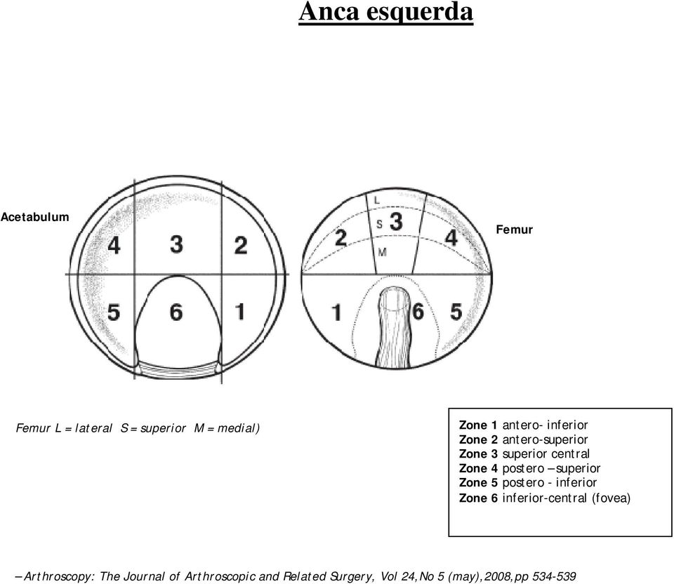 superior Zone 5 postero - inferior Zone 6 inferior-central (fovea) Arthroscopy: