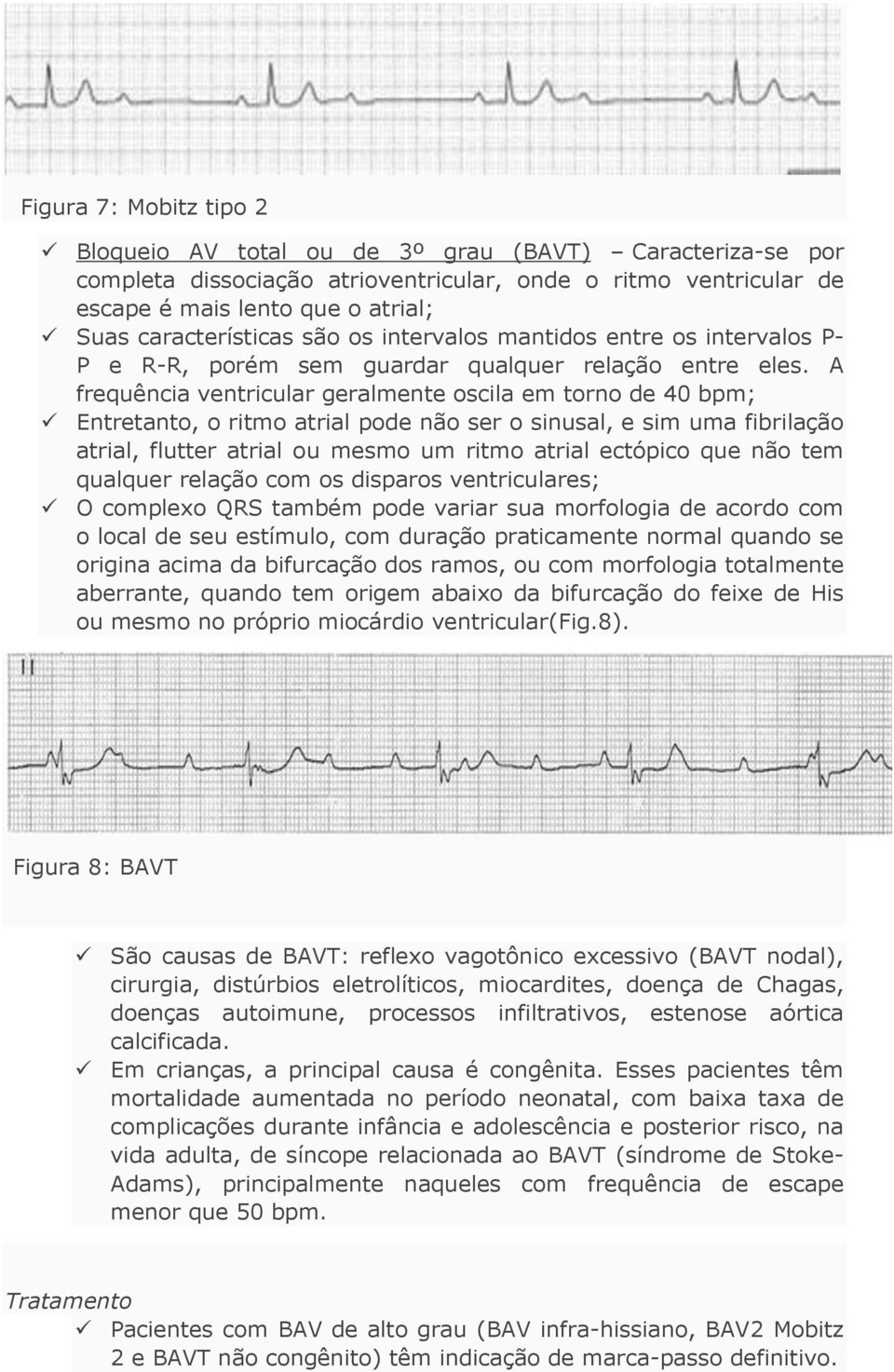 A frequência ventricular geralmente oscila em torno de 40 bpm; Entretanto, o ritmo atrial pode não ser o sinusal, e sim uma fibrilação atrial, flutter atrial ou mesmo um ritmo atrial ectópico que não