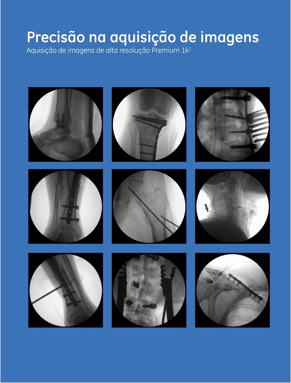 Aquisição de imagens