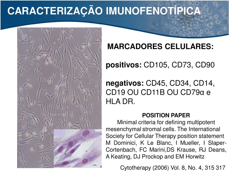 POSITION PAPER Minimal criteria for defining multipotent mesenchymal stromal cells.