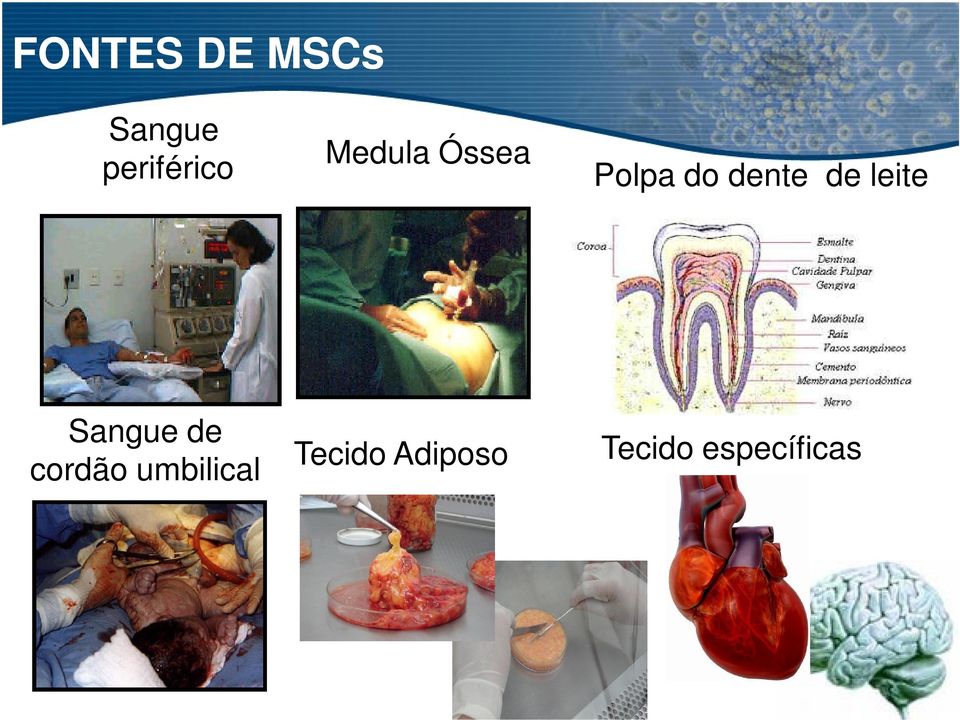 leite Sangue de cordão umbilical