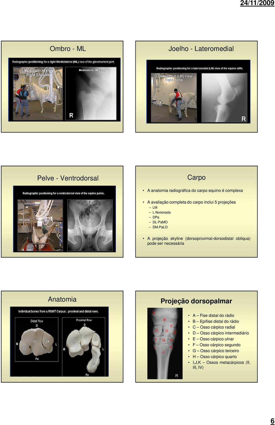 necessária Anatomia Projeção dorsopalmar A Fise distal do rádio B Epífise distal do rádio C Osso cárpico radial D Osso cárpico