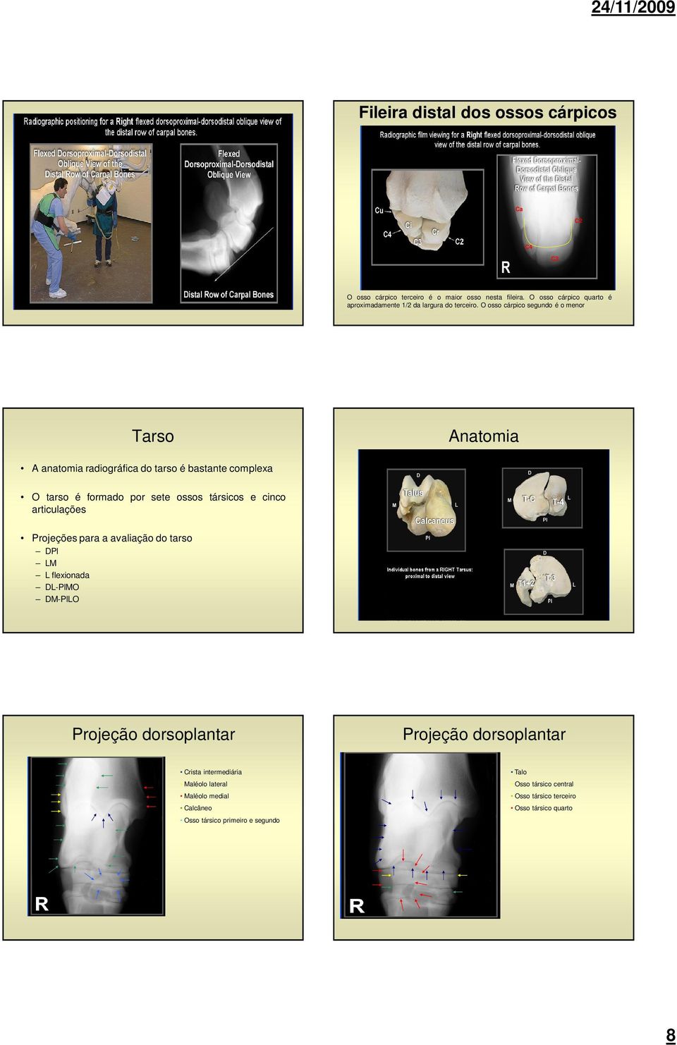 O osso cárpico segundo é o menor Tarso Anatomia A anatomia radiográfica do tarso é bastante complexa O tarso é formado por sete ossos társicos e cinco