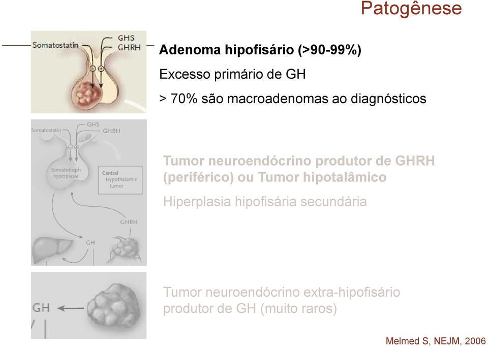 (periférico) ou Tumor hipotalâmico Hiperplasia hipofisária secundária