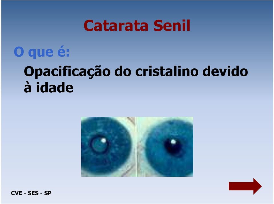 do cristalino