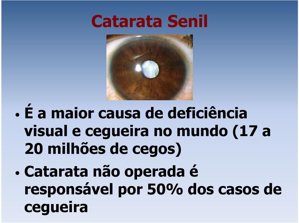 (17 a 20 milhões de cegos) Catarata não