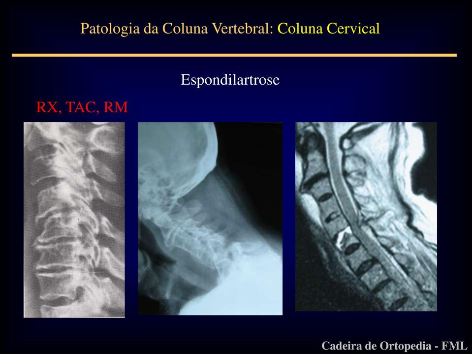 Coluna Cervical