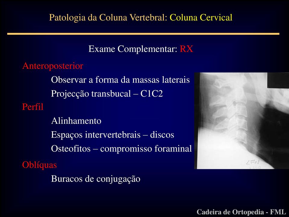 laterais Projecção transbucal C1C2 Perfil Alinhamento Espaços