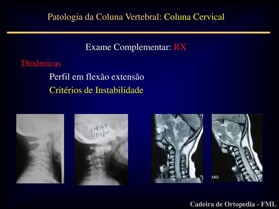 Complementar: RX Dinâmicas